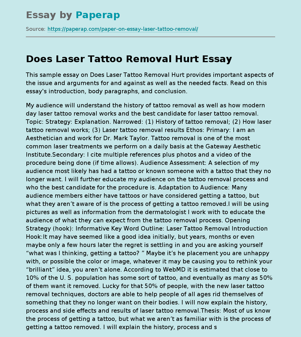 Does Laser Tattoo Removal Hurt